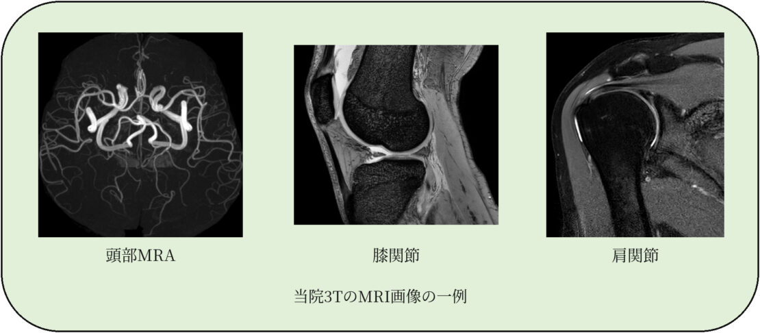 当院3TのMRI画像の一例