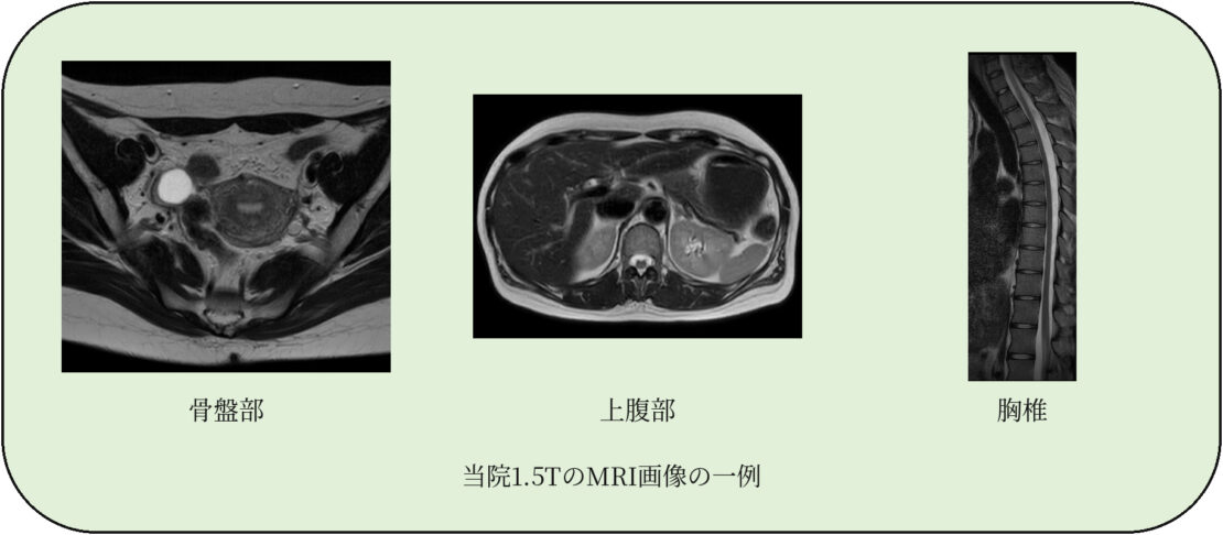 当院1.5TのMRI画像の一例