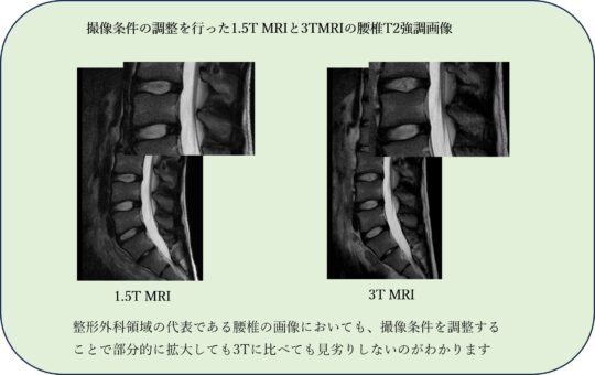 撮影条件調整を行った1.5TMRIと3TMRIの腰椎T2強調画像