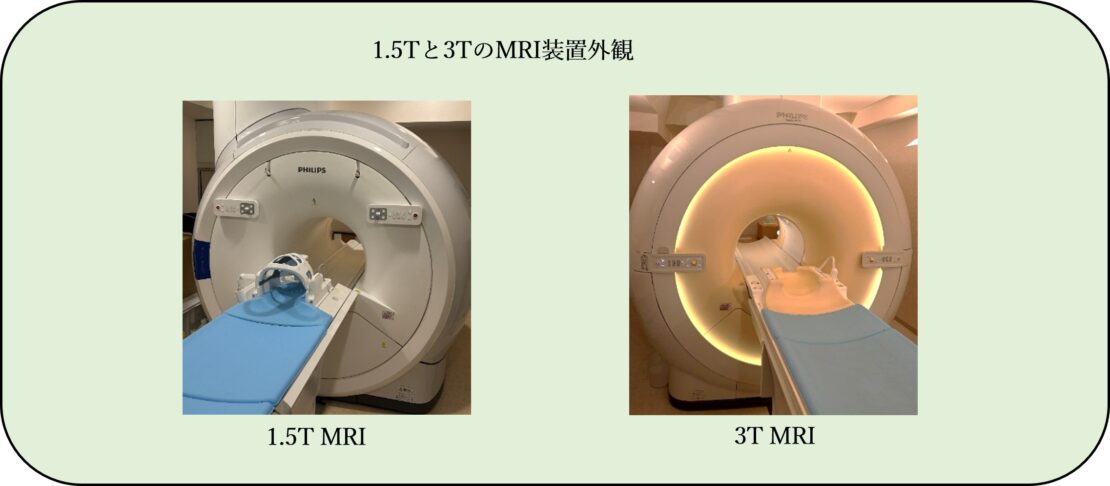 1.5Tと3TのMRI装置外観